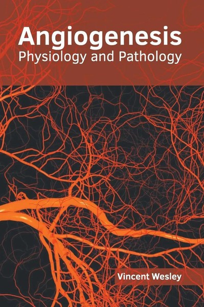 Vincent Wesley | Angiogenesis | Buch | Englisch (2019) | Gebunden-image