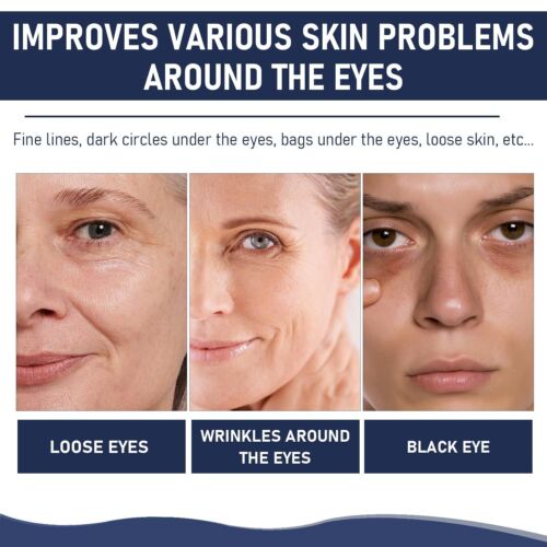 2 PCS Rapid Reduction Eye Serum, Anti Aging Serum Visibly Reduces Under-Eye Bags - Picture 7 of 7