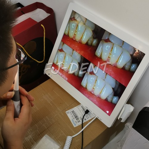 Cámara dental digital 16 millones cámara oral inalámbrica WiFi monitor de pantalla de 17 pulgadas - Imagen 2 de 9