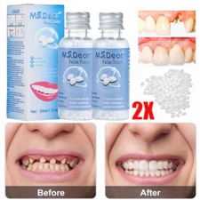 False Teeth Solid Glue Temporary Tooth Gap Filler Tooth Repair Moldable Denture