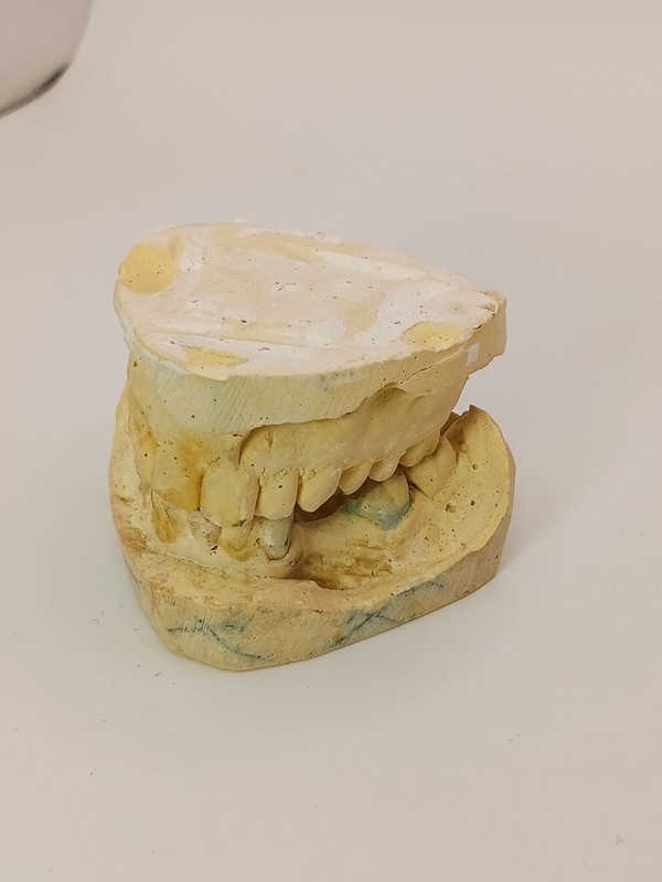 Vintage Plaster Teeth Mold