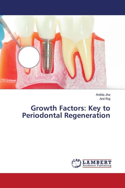 Growth Factors: Key To Periodontal Regeneration Ankita Jha (U. A.) Taschenbuch-image