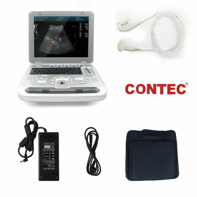 CMS1700B Color Doppler CF Ultrasound Scanner Machine ultrasonic Convex Probe FDA