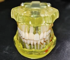 REDLAND Dental Demonstration Teeth Model Dentist  Education & Sales -MODEL#1065
