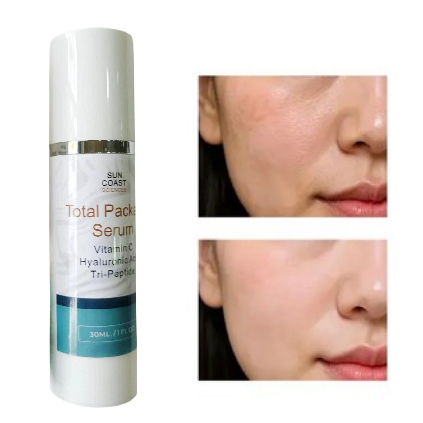 Sun Coast Science Total Package Serum, Vitamin C, Hyaluronic Acid, 30ML US STOCK