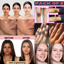 Dark Skin Bleaching Cream Whitening Lightening AHA-Face  Body-15g Pack of 2