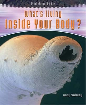 Whats Living Inside Your Body (Hidden Life), Solway, Andrew, gebraucht; sehr gute Bo