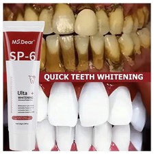 Sp-4 Probiotic Toothpaste for Whitening Bleaching Teeth Breath Removal Cleaning