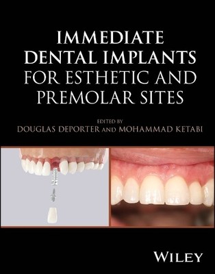 Immediate Dental Implants for Esthetic and Premolar Sites by ... - 9781394187102