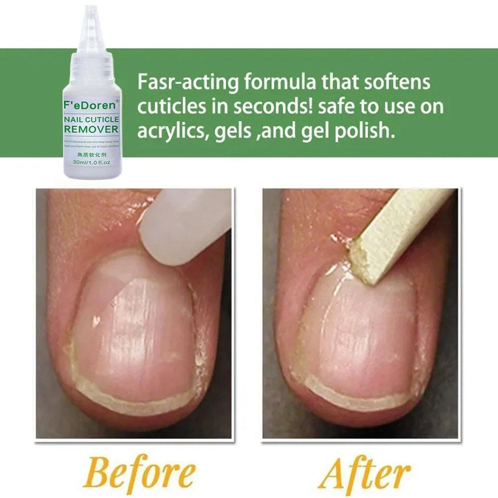 Cuticle remover gel outlet