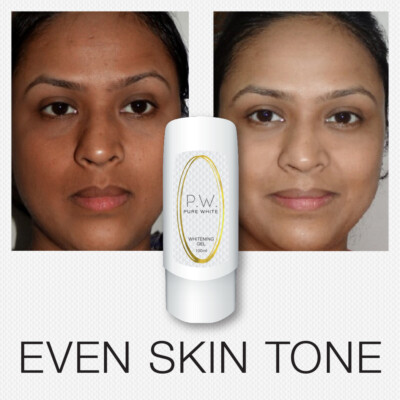 PURE WHITE WHITENING GEL TEINT EBENMÄSSIGER HAUTTON VERBLASSEN HAUTVERFÄRBUNGEN