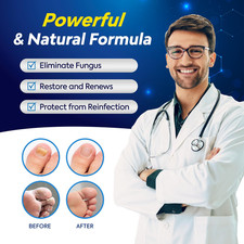 Toenail Fungus Treatment with 25 Undecylenic Acid, Toe Fungus Treatment for ...