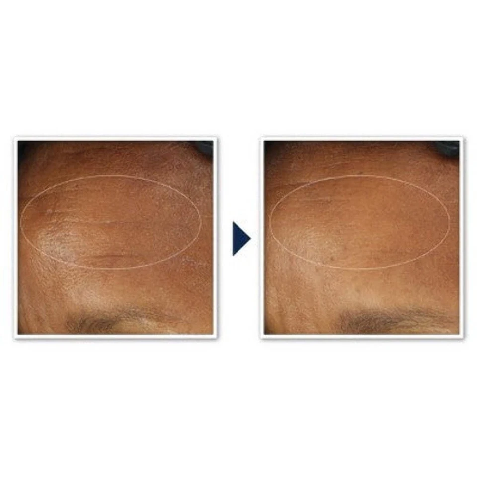 RoC 视黄醇 Correxion 深层抗皱保湿霜 SPF 30 1 液量盎司 - 全新 — 第 2/4 张图片