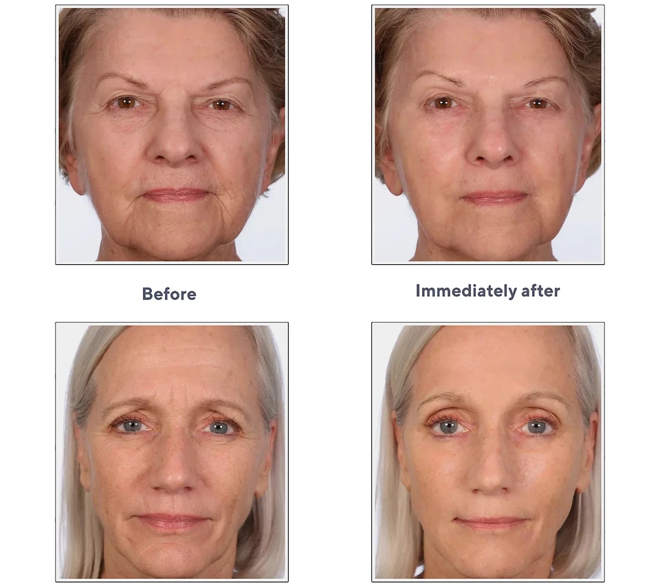 Serious Skincare Insta-Tox Suero Suavizante de Arrugas 1.42 OZ/42ml Nuevo SELLADO Foto 4 de 4