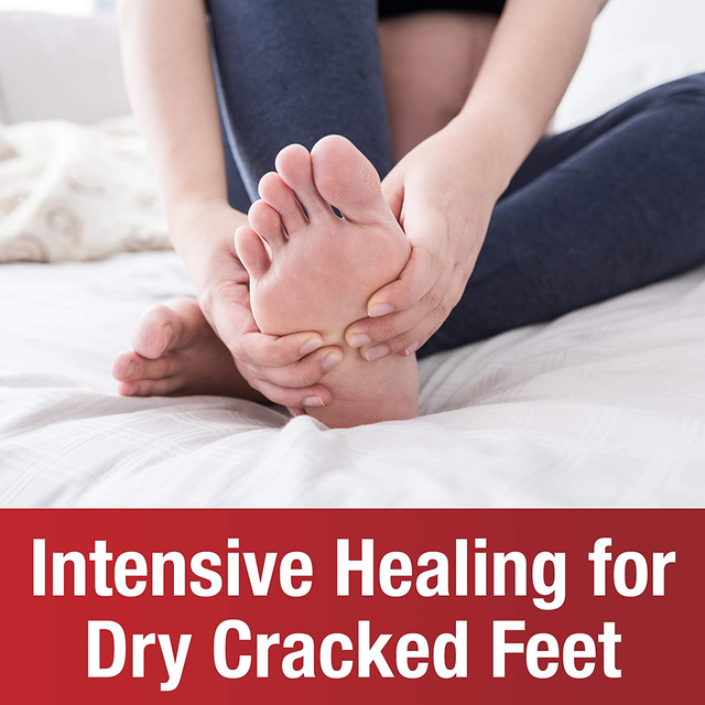 kerasal cracked heel cream