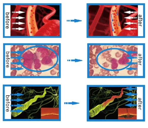 Terapia láser de bajo nivel 650 nm + 808 nm para dispositivo de terapia de luz roja para el dolor - Imagen 13 de 21