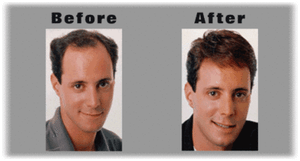 Hair Club For Men Members Let Us Duplicate Your Hairpiece And