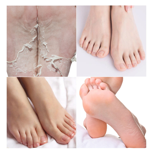 Fußpeeling Maske Pfirsich 2 Paar Peeling harte tote Haut Socken weiche Füße Palmarisa - Bild 2 von 7