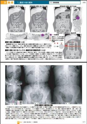 放射線科医のものの見方・考え方 | eBay