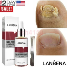 LANBENA Nail Repair Essence Oil Remove Onychomycosis Serum Fungal Nail Treatment