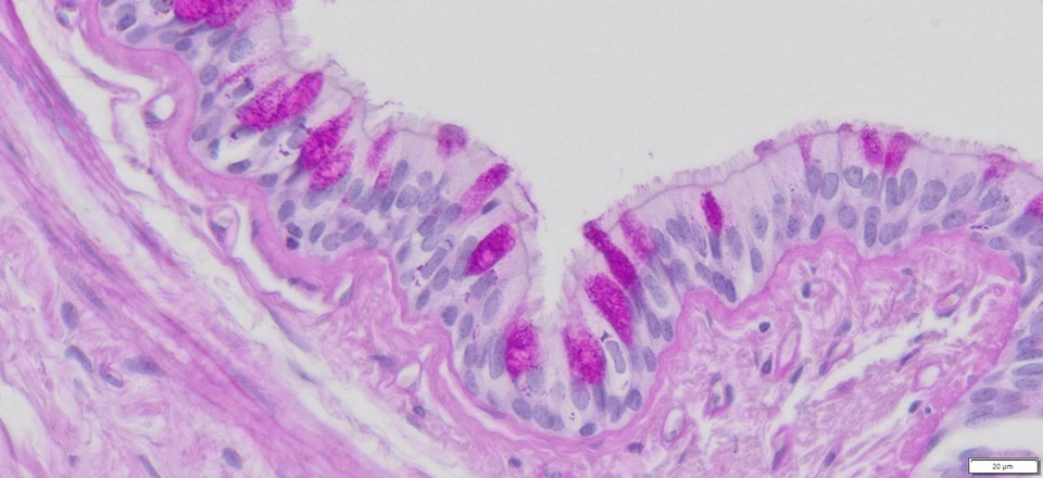 Kit de manchas VitroView™ PAS (Cat#VB-3004) Foto 4 de 4