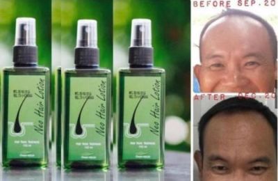 3x Neo Hair Lotion 120 ml Hair Treatment Root Nutrients Herb Effective 100%