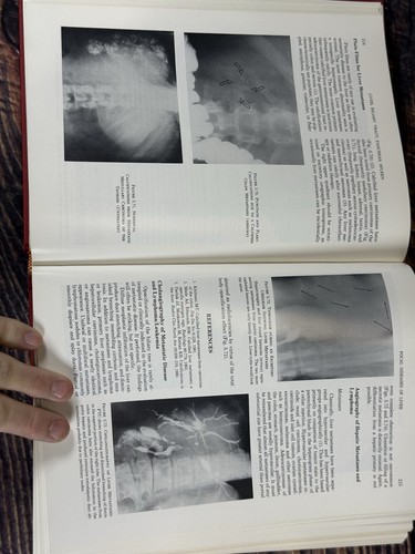 Radiology of Liver, Biliary Tract, Pancreas and Spleen Arnold C. Friedman - Picture 6 of 6