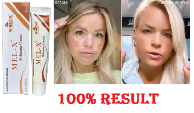 Crème Anti-mélasma Wheezal Mel-X - 25 G, Soin Réparateur Pour Le Visage, Sans Cruauté Animale