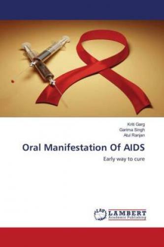Thumbnail - Oral Manifestation Of Aids Early Way To Cure 3000