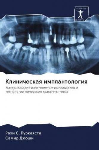 Thumbnail - Klinicheskaq Implantologiq Materialy Dlq Izgotowleniq Implantatow I