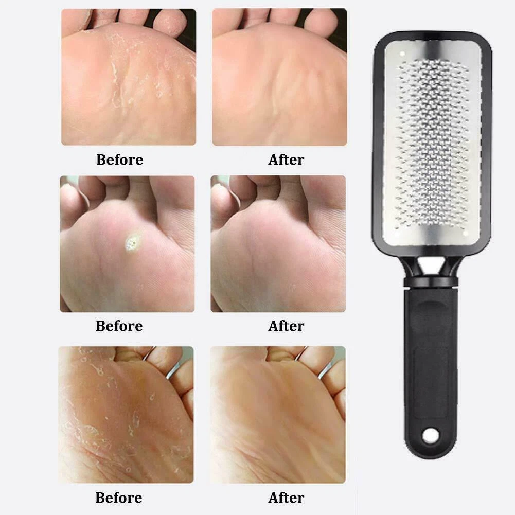 Professional Pedicure Knife Set Nail Knives Tools Foot Care Hand Callus  Dead Skin Removal Nail Scraper File