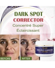 Dark Skin Whitening Dark Spot Brightening Bleaching Lightening Face Body Creams