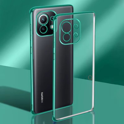 Luxury Plating Case für Xiaomi Mi 11 Lite 5G NE 11T Pro 11i 12 10 Soft Cover