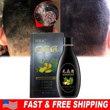2026 Scalp Hair Follicle Shampoo Antibacterial Anti-Itching Mites Oil Control US