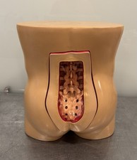 Vertebroplasty Trunk Short Back Medical Research Orthopaedic Model  NEW!