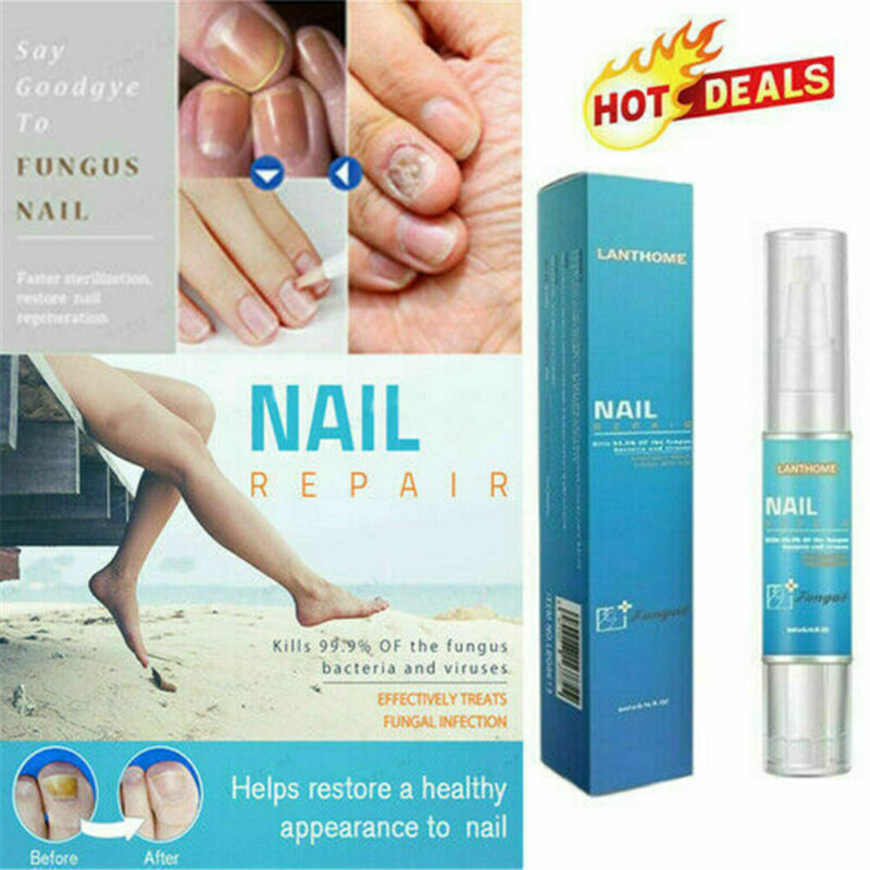Amazon.com : Multi-Purpose Fungus Nail Patches, Toenail Fungus Treatment, Nail  Fungus Treatment for Toenail, Ingrown Toenail Treatment, Toe Nail Fungus  Treatment Extra Strength, Nighttime Fungal Nail Patches : Health & Household