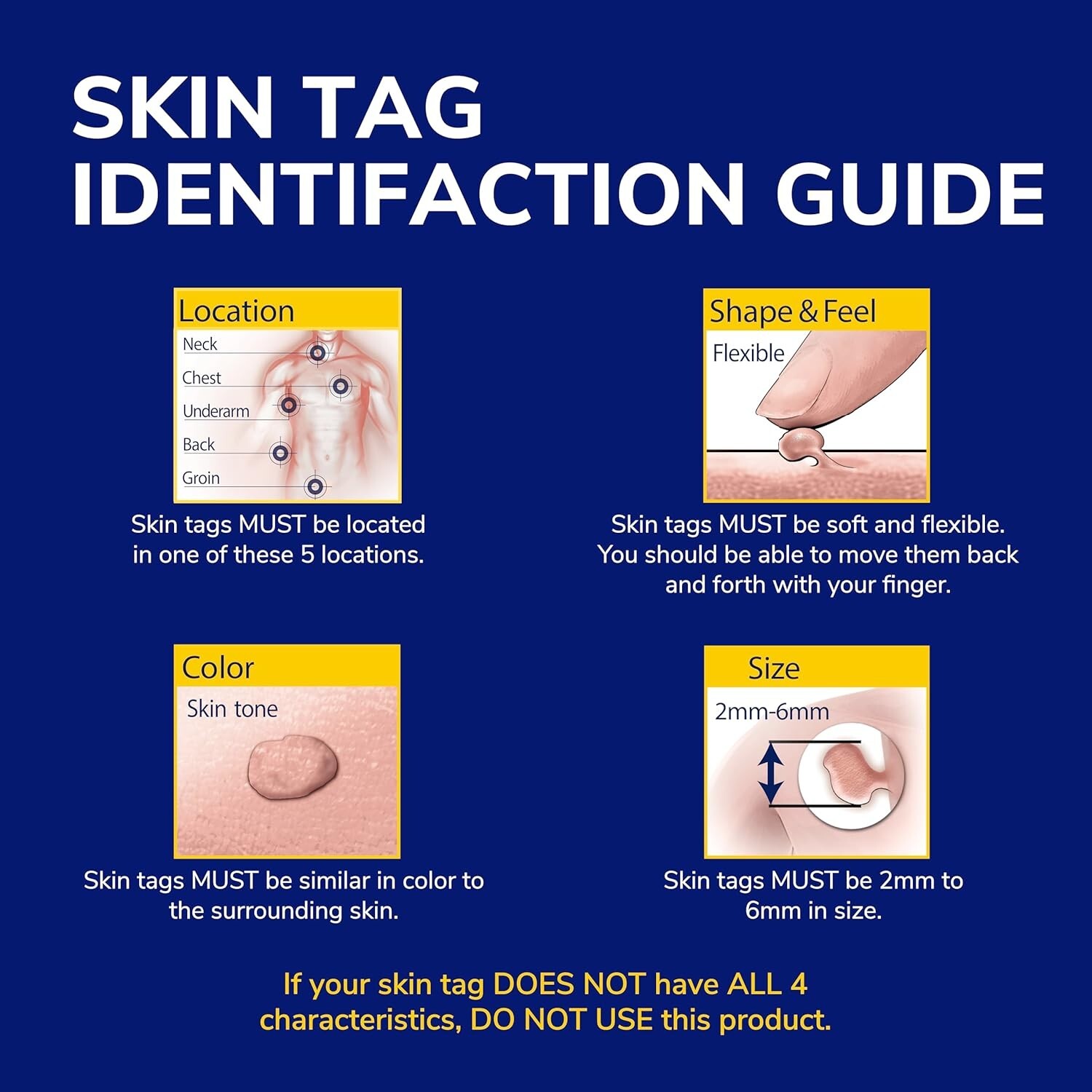 Quemar Verrugas Para Quitar Mezquinos Remedio Remover Quitador De Verrugas NUEVO