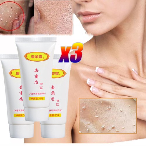 3Pcs Whitening Peeling Facial Scrub Gel Natural Exfoliating Dead Skin Remover US