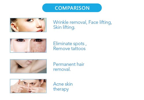 SHR IPL OPT machine Hair Removal ND Yag laser Skin Rejuvenation Tattoo Removal - Picture 9 of 9