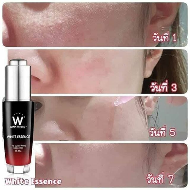 white essence serum