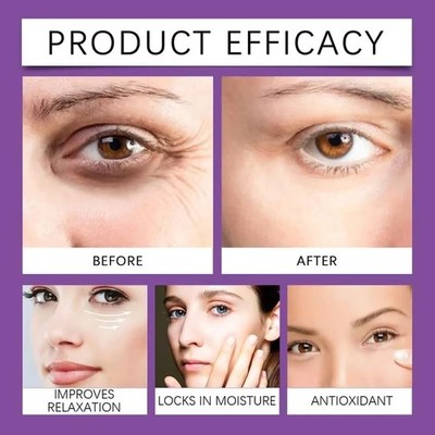 Pro-Essence Active Anti-Wrinkle Eye Cream for Dark Circles,Puffiness & Fine Line
