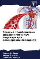 Bogatyj Trombocitami Fibrin (Prf): Luch Nadezhdy Dlq Regeneracii Parodonta Buch