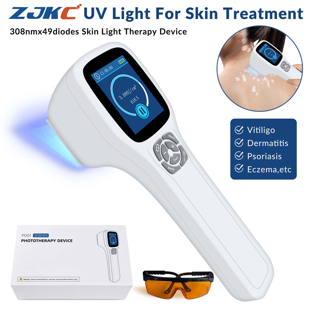 ZJKC 308nm Excimer Blue Light Phototherapy for Skin Diseases Treatment Device