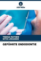 GefÜHrte Endodontie Treesa Mathew