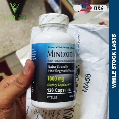 MINOXIDINA 1000mg Crecimiento del Cabello 120 Comprimidos Extra Fuerza Hombres Mujeres Recrecimiento EE. UU. - Imagen 16 de 21