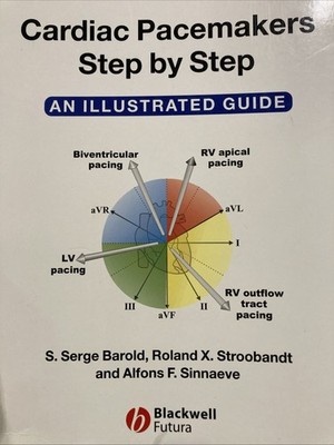 Cardiac Pacemakers Step-by-Step: An Illustrated Guide