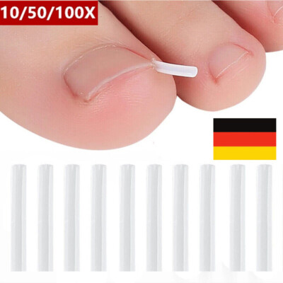 1-100X Zehennagel Glättung Clip Eingewachsen Zehennagel Korrektur Nagel Pflaster