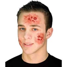 Woochie Morning After Latex Appliance, 3-piece wound prosthetic