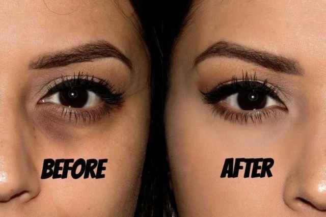 Himalaya Herbals Under Eye Cream Remove Dark Circles Wrinkles Lines in 4 weeks  - Image 3 of 4