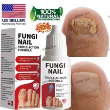 Fungi-Nail Anti-Fungal Liquid Solution Kills Fungus That Can Lead To Nail